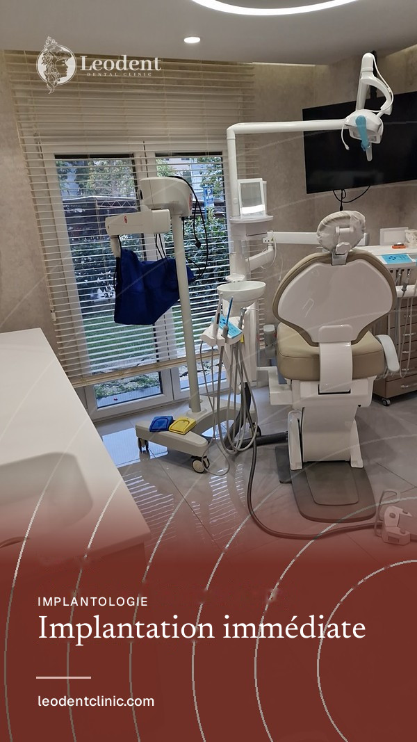 Implantation immédiate | Leodent Clinic