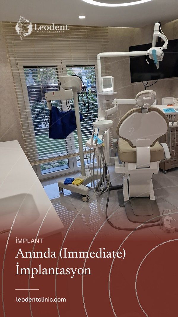 Anında (Immediate) İmplantasyon | Leodent Clinic