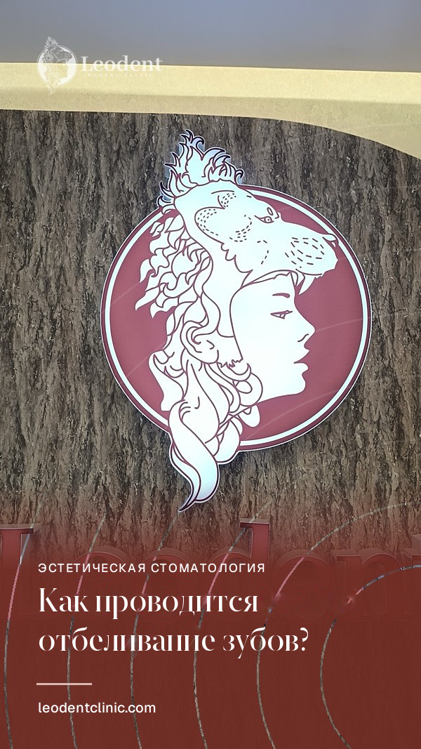 Как проводятся процедуры отбеливания зубов?