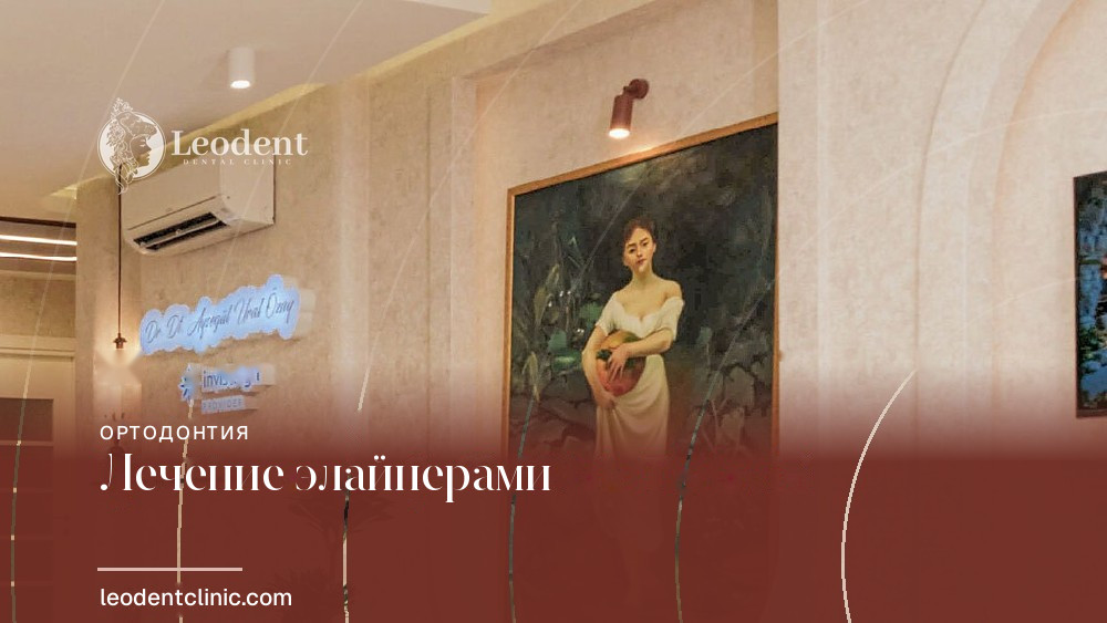 Мнение специалиста — лечение элайнерами | Dr. Dt. Ayşegül Ural Özay